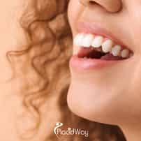 Ridge Augmentation in San Jose, Costa Rica: Understanding Costs Before You Decide